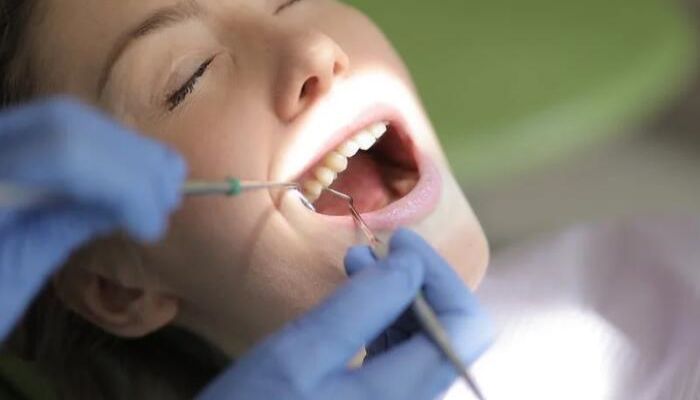植牙手術前有哪些注意事項