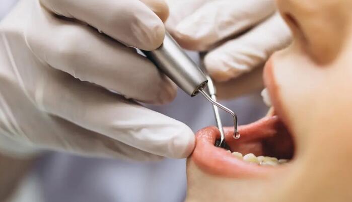 牙周翻瓣手術會痛嗎？
