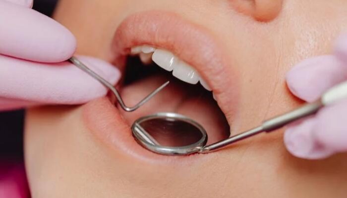 牙周病如何預防？