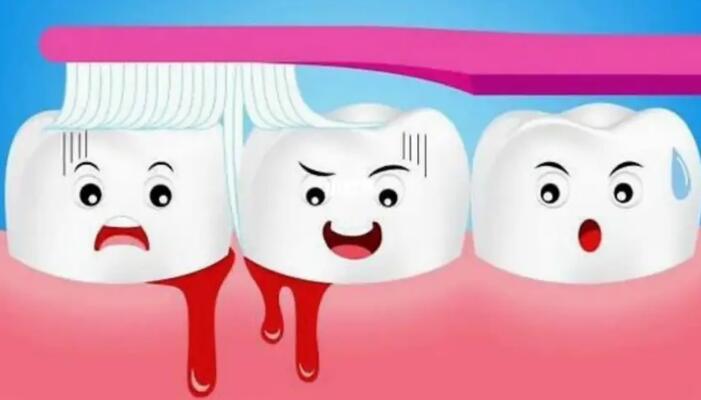 牙齦流血原因、牙齦流血是什麽引起的