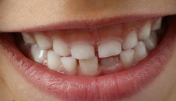 牙齒生長順序