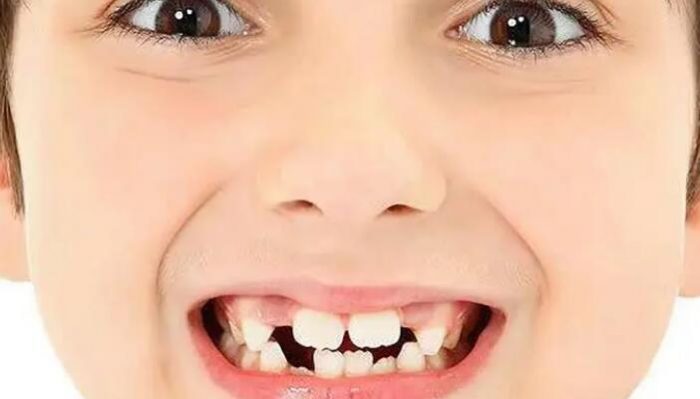 小朋友牙齒黑什麼原因？