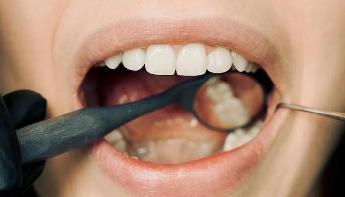 補完牙吃東西會痛怎麼辦？