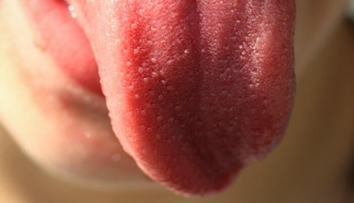 舌頭潰瘍看哪科