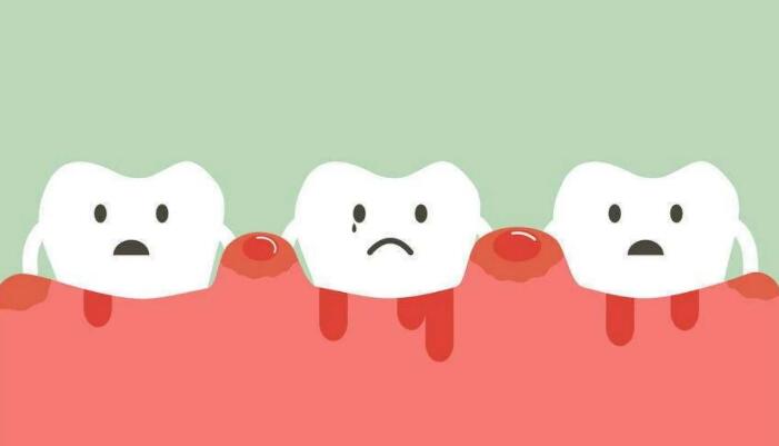 牙周病治療要多久？