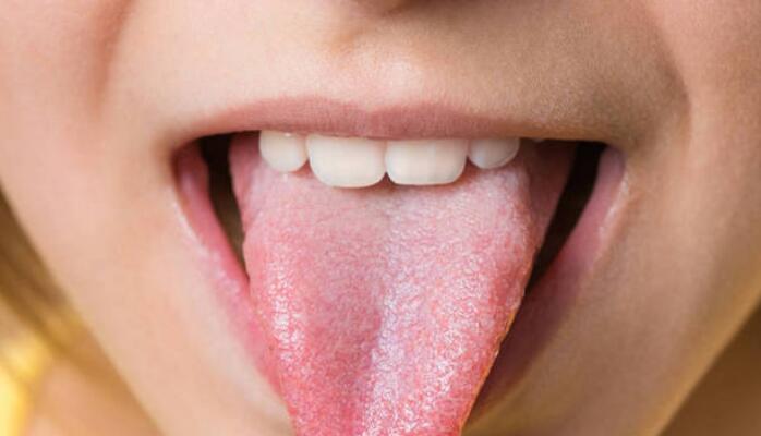 舌苔白如何改善