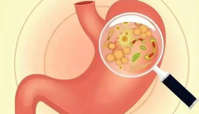 胃炎能吃益生菌調理嗎